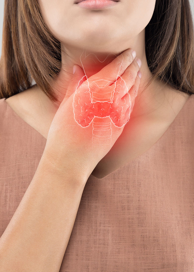 Thyroid Thyroid